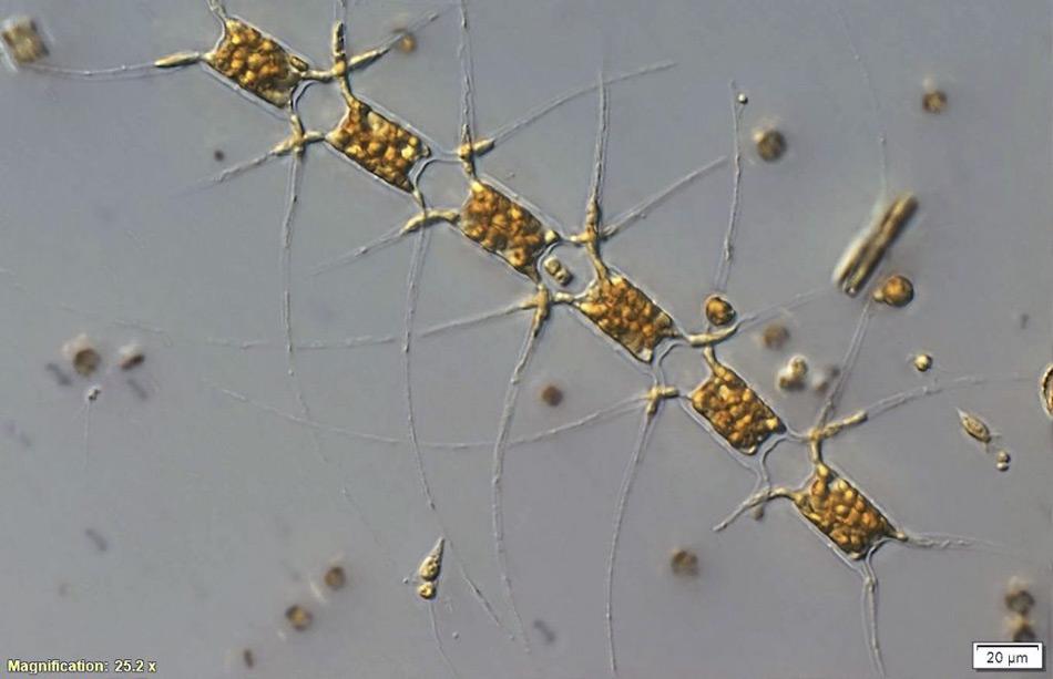 Einzellige marine Pflanzen, Phytoplankton, bilden die Basis des antarktischen Nahrungsnetzes. Sie ermöglichen die immense Vielfalt des Lebens in der Antarktis einschließlich des Krills, der Robben, Pinguine und Wale. Die Phytoplankton-Zellen wurden unter dem Mikroskop vergrößert, jede Kette ist ca. 200 μm (Mikrometer) lang, dies entspricht etwa 1/5 Millimeter - oder 1/5 eines Stecknadelkopfes. (Bild: Alyce Hancock)
